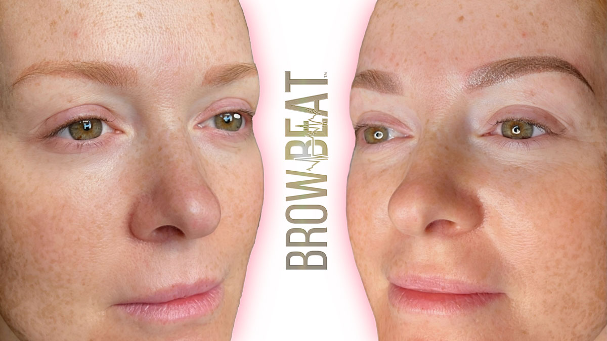 brow correction before next session