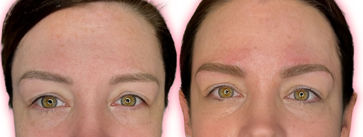 How to Choose the Right Artist for Microblading Correction