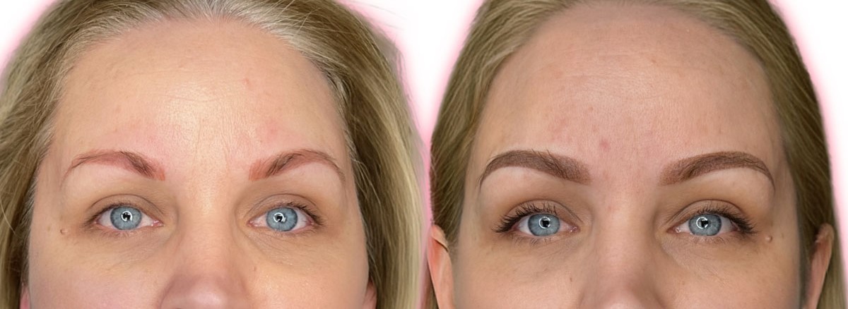 brows needing microblading fix after multiple sessions Dallas TX