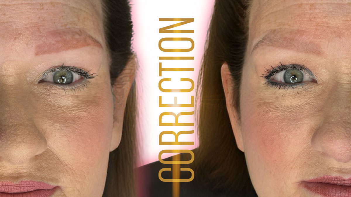 correcting old eyebrow tattoo pigment with structured approach