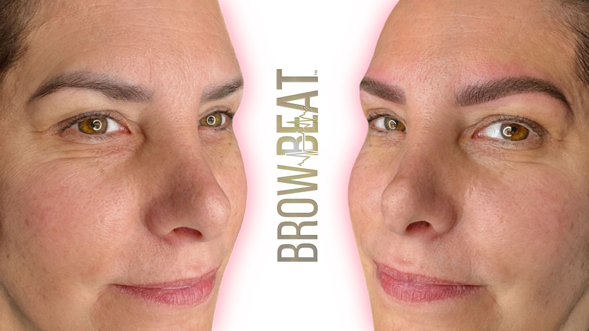 assessing dense eyebrow pigment before correction