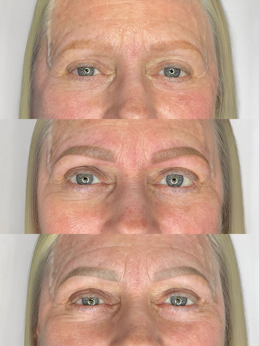 Before and after red eyebrow tattoo correction showing mature skin with unwanted red healed pigment professionally corrected.
