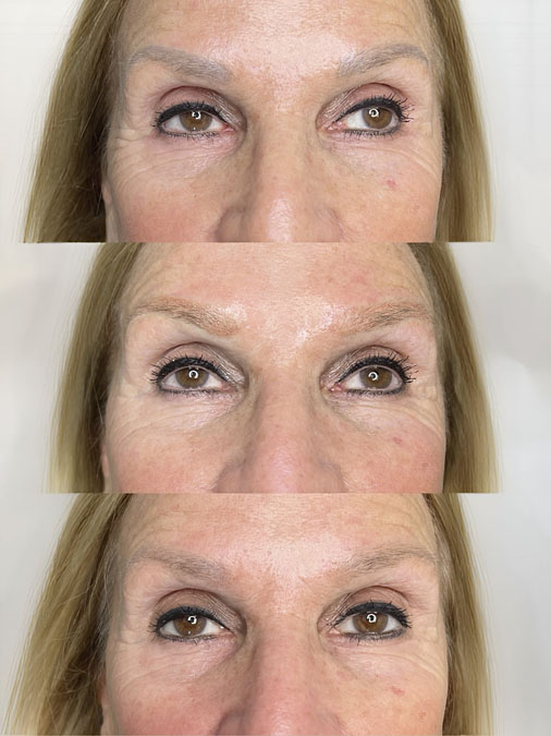Grey Eyebrow Tattoo Correction Before and After