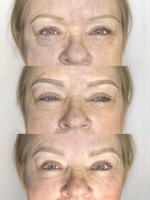 efore and after poor microblading shape correction showing previous microblading professionally redesigned into a softer, balanced eyebrow shape.