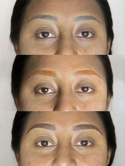 Educational consultation explaining why eyebrow tattoos hidden beneath microblading often become visible years later.