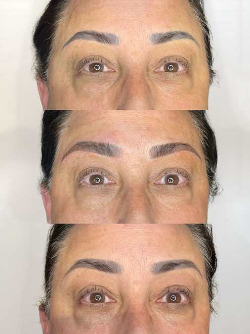 Tattoo Covered by Microblading Before and After