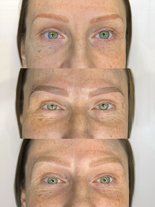 Before and after old eyebrow tattoo correction showing faded and shifted eyebrow tattoo pigment professionally corrected.