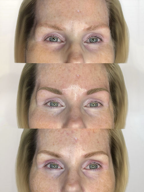eyebrow tattoo refresh versus correction consultation showing healed brows professionally evaluated before treatment recommendations.
