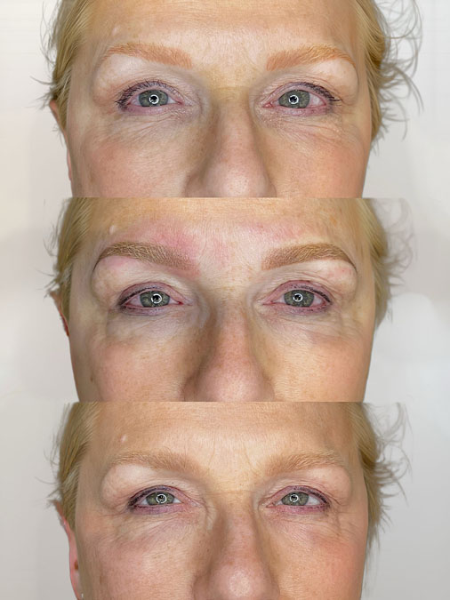 Understanding Warm Pigment Before Correction