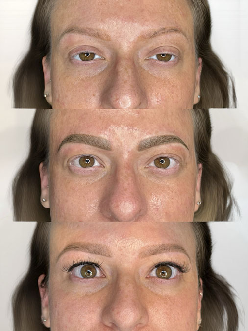Before and after correction of blurry blown-out microblading with softer edges and improved eyebrow definition