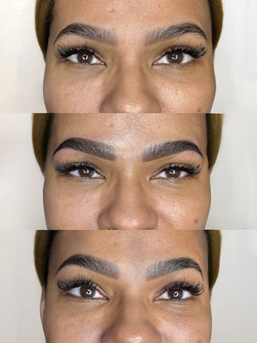 Complete eyebrow correction decision journey showing previous brows, after procedure and final healed result after individualized treatment planning.