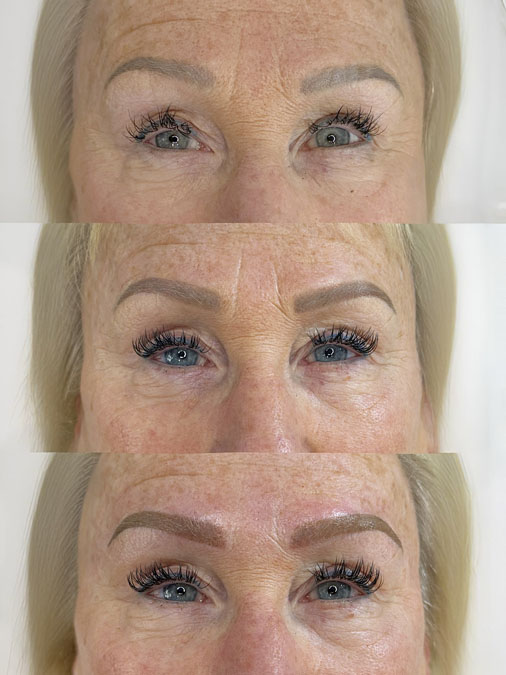 Microblading Over Tattoo Before and After