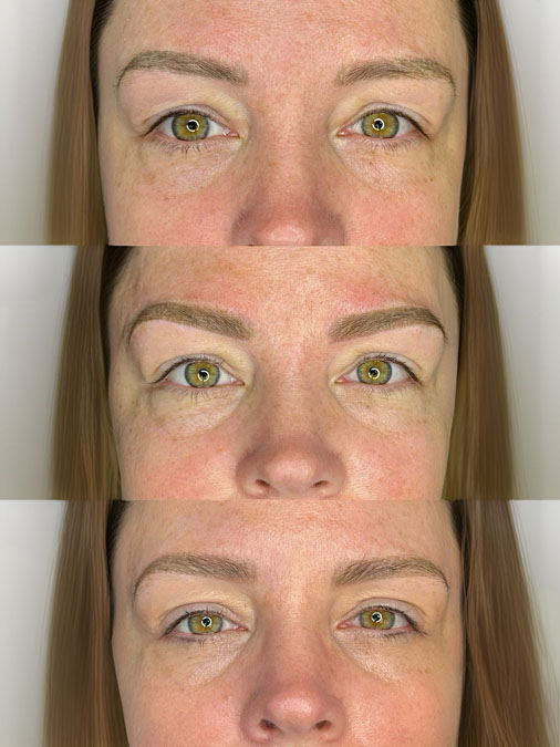 Before and after faded eyebrow tattoo repair showing naturally faded cosmetic eyebrow tattoo professionally restored into a more defined appearance.