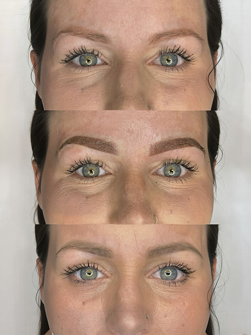 Educational consultation explaining how regular maintenance helps prevent excessive warmth in permanent makeup.