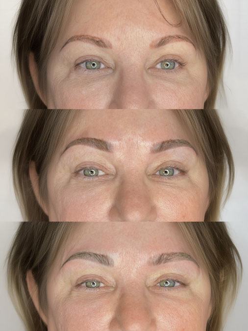 Multiple layers of microblading correction before and after
