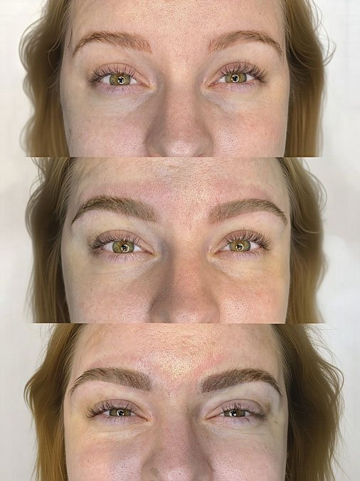 Multiple Microblading Treatments to Soft Powder Brow Correction